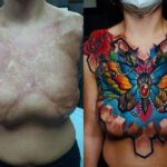 Cover-Up Tattoo einer Frau mit einer vernarbten Brust mit geometrischen Schmetterlingsmotiv